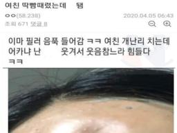 <strong>여친</strong> 딱밤 대참사 현장