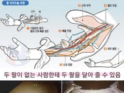 머리 전체를 이식하는 수술까지도 성공한.. '현대 <strong>의학</strong>이 손도 못대고 있는 영역'