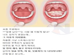 요즘 <strong>입</strong>병 난다는 사람들이 많아진 진짜 이유..