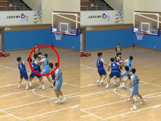 [영상] 농구경기중 상대 얼굴 '퍽'…쓰러진 중학생 안면골절 우려