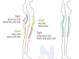 코어 <strong>근육</strong>이 무너진 사람들 특..