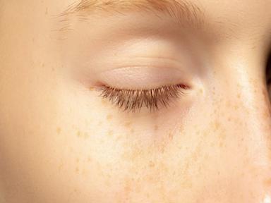 기미일까 주근깨일까?...거뭇한 잡티 없애는 법