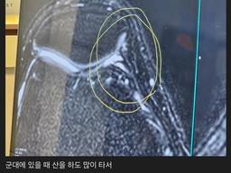 <strong>무릎</strong>내주고 초능력 얻은 익붕이 ㄷㄷㄷ