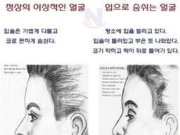 정상의 이상적인 얼굴 vs <strong>입</strong>으로 숨쉬는 얼굴..ㄷㄷㄷ