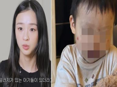 "심하게 붓고 고름까지"..손연재 아들 앓은 '스키터 증후군' 뭐길래
