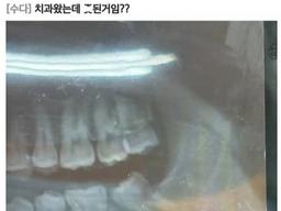 <strong>치과</strong> 왔는데 ㅈ된 거임?