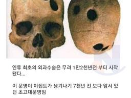12000년전에 행해진 <strong>뇌</strong>수술 ㄷㄷ..jpg
