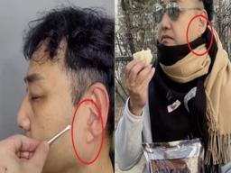 귓불 사선 주름, 정수리 탈모... 우리 몸이 보내는 경고를 무시말라